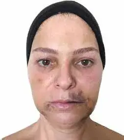 img268